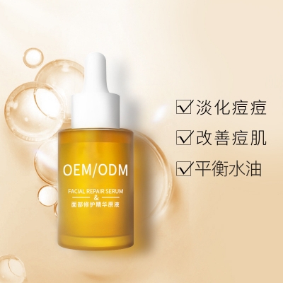 朝阳市_祛痘精华原液OEM
